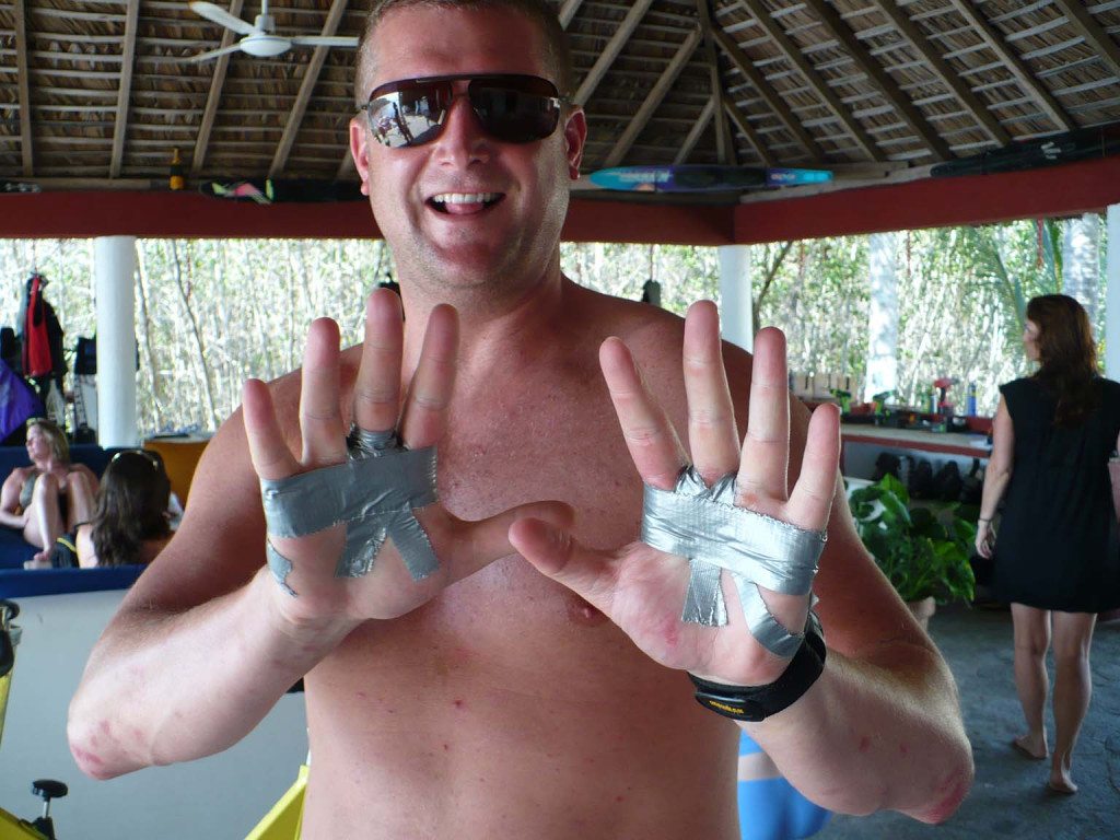 Man On Cocaine Suffers Friction Burns To The Penis After Failing To Pull On Night Out