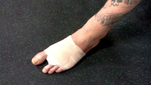 Shuffler Loses Toe In Horrific “Stubbing” Incident